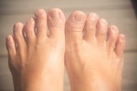 What Is Splay Foot?